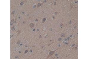 IHC-P analysis of Human Tissue, with DAB staining. (BIRC6 抗体  (AA 4576-4857))