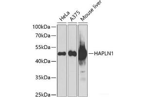 Western blot analysis of extracts of various cell lines using HAPLN1 Polyclonal Antibody at dilution of 1:1000. (HAPLN1 抗体)