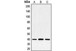 Western blot analysis of FRA2 expression in HeLa (A), MCF7 (B), PC12 (C) whole cell lysates.
