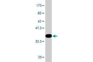 Western Blot detection against Immunogen (34. (LASS4 抗体  (AA 57-139))