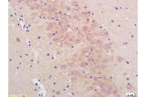 Formalin-fixed and paraffin embedded rat brain labeled with Anti-Phospho-Mcl1 (Ser159/Thr163) Polyclonal Antibody, Unconjugated (ABIN743738) at 1:200, followed by conjugation to the secondary antibody and DAB staining (MCL-1 抗体  (pSer159, pThr163))