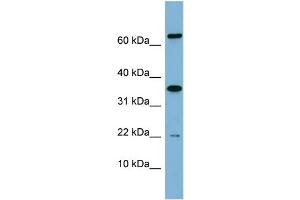 WB Suggested Anti-RWDD1  Antibody Titration: 0. (RWDD1 抗体  (Middle Region))
