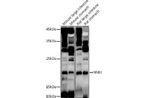 Western blot analysis of extracts of various cell lines, using NMU antibody (ABIN6128376, ABIN6144691, ABIN6144692 and ABIN6222862) at 1:1000 dilution. (Neuromedin U 抗体  (AA 35-174))
