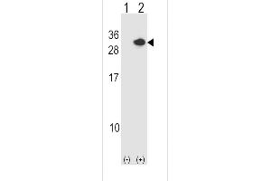 Western blot analysis of RCAN1 (arrow) using rabbit polyclonal RCAN1 Antibody (N-term) (ABIN1539360 and ABIN2848483). (RCAN1 抗体  (N-Term))