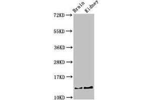 Western Blot Positive WB detected in: Mouse brain tissue, Mouse kidney tissue All lanes: PVALB antibody at 3 μg/mL Secondary Goat polyclonal to rabbit IgG at 1/50000 dilution Predicted band size: 13 kDa Observed band size: 13 kDa (PVALB 抗体  (AA 2-110))