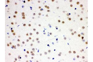 Anti- Cdc25B Picoband antibody, IHC(P) IHC(P): Mouse Brain Tissue (CDC25B 抗体  (AA 119-248))
