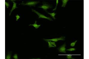 Immunofluorescence of monoclonal antibody to ARMET on HeLa cell. (MANF 抗体  (AA 116-185))