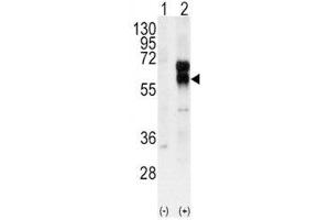 Western Blotting (WB) image for anti-Activin A Receptor Type II-Like 1 (ACVRL1) (AA 38-68) antibody (ABIN3029853)