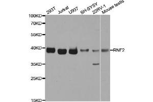 Western blot analysis of extracts of various cell lines, using RNF2 antibody.