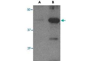 Western blot analysis of (A) 5 ng and (B) 25 ng of recombinant Hemagglutinin with Avian Influenza Hemagglutinin polyclonal antibody  at 1 ug/mL . (Hemagglutinin 抗体  (N-Term))