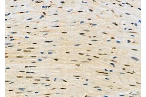ABIN6261533 and ABIN6277673 at 1/100 staining Mouse heart tissue by IHC-P.