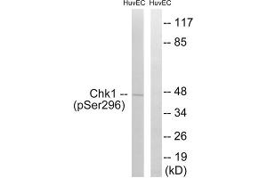 Western blot analysis of extracts from HUVEC cells, treated with UV (15mins), using CHK1 (Phospho-Ser296) antibody. (CHEK1 抗体  (pSer296))