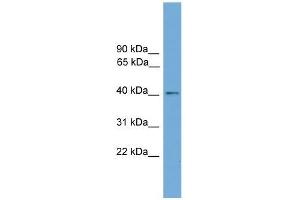 Human HeLa; WB Suggested Anti-ZDHHC18 Antibody Titration: 0. (ZDHHC18 抗体  (Middle Region))