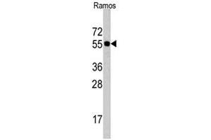 Western blot analysis of CDC6 polyclonal antibody  in Ramos cell lysate (35 ug/lane). (CDC6 抗体  (N-Term))
