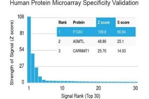 Analysis of HuProt(TM) microarray containing more than 19,000 full-length human proteins using Factor XIIIa antibody (clone F13A1/1683). (F13A1 抗体  (AA 46-181))