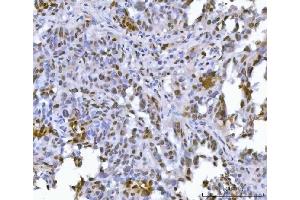 IHC analysis of FIP1L1 using anti-FIP1L1 antibody (ABIN7600761). (FIP1L1 抗体  (AA 23-558))