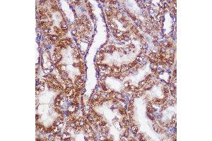 Immunohistochemistry of paraffin-embedded Rat kidney using PIGM Rabbit pAb (ABIN7269294) at dilution of 1:100 (40x lens). (PIGM 抗体  (AA 35-96))
