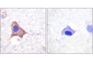 Immunohistochemistry analysis of paraffin-embedded human brain, using CD71/TfR (Phospho-Ser24) Antibody. (Transferrin Receptor 抗体  (pSer24))