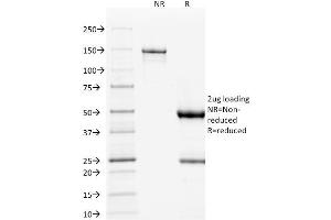 SDS-PAGE (SDS) image for anti-Tumor Protein P53 (TP53) antibody (ABIN6940788)