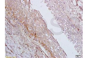 Formalin-fixed and paraffin embedded rat ovary tissue labeled with Anti-AGPAT4 Polyclonal Antibody, Unconjugated (ABIN708671) at 1:200 followed by conjugation to the secondary antibody, (SP-0023), and DAB staining (AGPAT4 抗体  (AA 231-330))