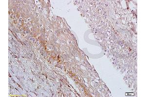 Formalin-fixed and paraffin embedded rat ovary tissue labeled with Anti-AGPAT4 Polyclonal Antibody, Unconjugated (ABIN708671) at 1:200 followed by conjugation to the secondary antibody, (SP-0023), and DAB staining
