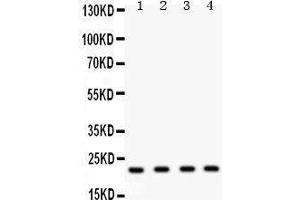 Anti-Securin antibody, Western blotting All lanes: Anti PTTG1  at 0.