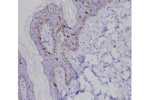 Immunohistochemical analysis of paraffin-embedded human skin, using Langerin (CD207) Antibody.