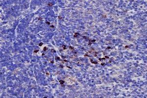 Immunohistochemistry analysis of paraffin-embedded rat spleen using,PRELID1 (ABIN7075173) at dilution of 1: 4000
