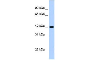 WB Suggested Anti-ZNF187 Antibody Titration:  2. (ZNF187 抗体  (C-Term))