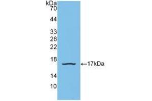 Detection of Recombinant SNRPD1, Human using Polyclonal Antibody to Small Nuclear Ribonucleoprotein Polypeptide D1 (SNRPD1) (SNRPD1 抗体  (AA 1-119))