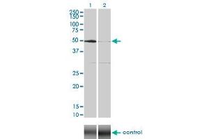 Western Blotting (WB) image for anti-serum/glucocorticoid Regulated Kinase 1 (SGK1) (AA 1-432) antibody (ABIN598922) (SGK1 抗体  (AA 1-432))