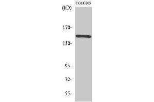 Western Blotting (WB) image for anti-RAD50 Homolog (S. Cerevisiae) (RAD50) (Internal Region) antibody (ABIN3186656) (RAD50 抗体  (Internal Region))