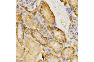 Immunohistochemistry of paraffin-embedded mouse kidney using CDC42 antibody at dilution of 1:200 (x400 lens) (CDC42 抗体)