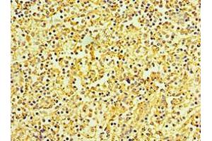 Immunohistochemistry of paraffin-embedded human spleen tissue using ABIN7145839 at dilution of 1:100 (KCTD15 抗体  (AA 1-234))