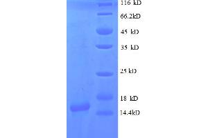 SDS-PAGE (SDS) image for gamma-Interferon-Induced Monokine (CXCL9) (AA 22-126) protein (His tag) (ABIN5712670) (CXCL9 Protein (AA 22-126) (His tag))