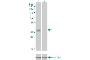 Western blot analysis of NDUFS3 over-expressed 293 cell line, cotransfected with NDUFS3 Validated Chimera RNAi (Lane 2) or non-transfected control (Lane 1). (NDUFS3 抗体  (AA 1-264))