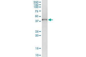 Immunoprecipitation of ADH1C transfected lysate using anti-ADH1C MaxPab rabbit polyclonal antibody and Protein A Magnetic Bead , and immunoblotted with ADH1C purified MaxPab mouse polyclonal antibody (B01P) . (ADH1C 抗体  (AA 1-375))
