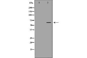 Western blot analysis of Jurkat  lysate using STIP1 antibody. (STIP1 抗体  (N-Term))