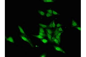 Immunofluorescent analysis of Hela cells using ABIN7155470 at dilution of 1:100 and Alexa Fluor 488-congugated AffiniPure Goat Anti-Rabbit IgG(H+L) (ASH1L 抗体  (AA 1906-2160))