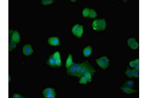 Immunofluorescence (IF) image for anti-Actin Related Protein 2/3 Complex, Subunit 3, 21kDa (ARPC3) (AA 2-175) antibody (ABIN7143089)