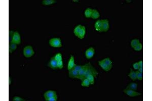 Immunofluorescent analysis of PC-3 cells using ABIN7143089 at dilution of 1:100 and Alexa Fluor 488-congugated AffiniPure Goat Anti-Rabbit IgG(H+L) (ARPC3 抗体  (AA 2-175))