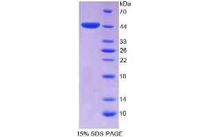 SDS-PAGE analysis of Rat EP300 Protein. (p300 蛋白)