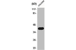 Western Blot analysis of COLO205 cells using Actin α3 Polyclonal Antibody (ACTG2 抗体  (N-Term))
