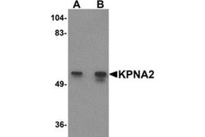 Western blot analysis of KPNA2 in rat heart tissue lysate with KPNA2 antibody at (A) 1 and (B) 2 μg/ml. (KPNA2 抗体  (N-Term))
