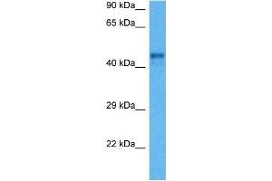 Host:  Mouse  Target Name:  REN1  Sample Tissue:  Mouse Heart  Antibody Dilution:  1ug/ml (Renin 抗体  (C-Term))
