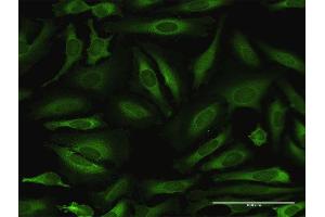 Immunofluorescence of purified MaxPab antibody to NARS on HeLa cell. (NARS 抗体  (AA 1-548))