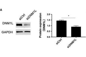 DNM1L deficiency alters mitochondria morphology and mitochondrial membrane potential in FLSs. (GAPDH 抗体)