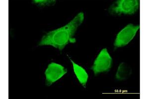 Immunofluorescence of purified MaxPab antibody to GEMIN6 on HeLa cell. (GEMIN6 抗体  (AA 1-167))
