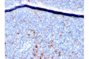 Formalin-fixed, paraffin-embedded human Tonsil stained with CD25 Mouse Monoclonal Antibody (IL2RA/2395).