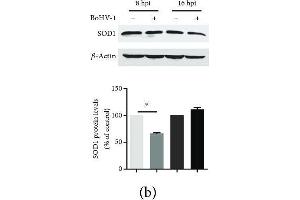 The effects of BoHV-1 infection on the gene expression of antioxidant enzymes. (SOD1 抗体  (AA 1-154))
